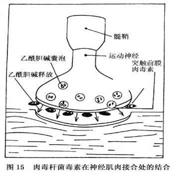 肉毒杆菌毒素