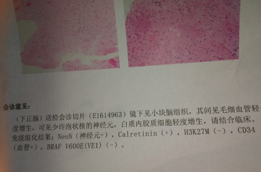 病理报告