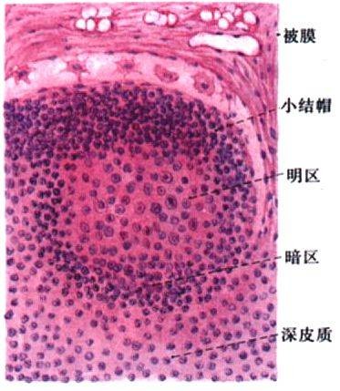 淋巴小结