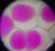 质壁分离（生物学词汇）
