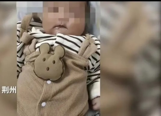 10·4荆州男婴接种疫苗后死亡事件
