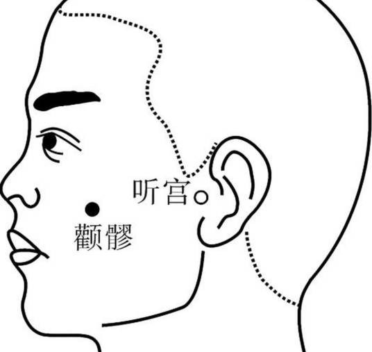颧髎