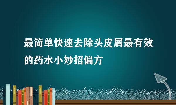 最简单快速去除头皮屑最有效的药水小妙招偏方