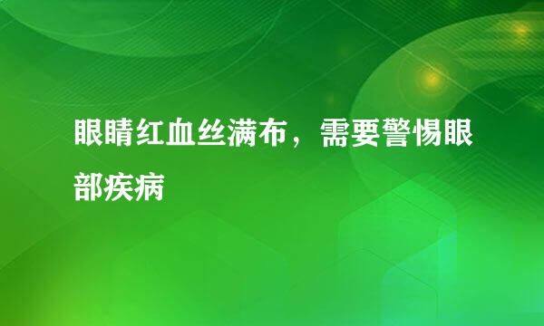 眼睛红血丝满布，需要警惕眼部疾病