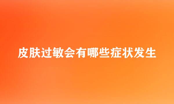 皮肤过敏会有哪些症状发生
