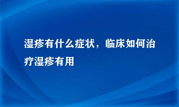 湿疹有什么症状,临床如何治疗湿疹有用