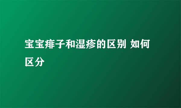 宝宝痱子和湿疹的区别 如何区分