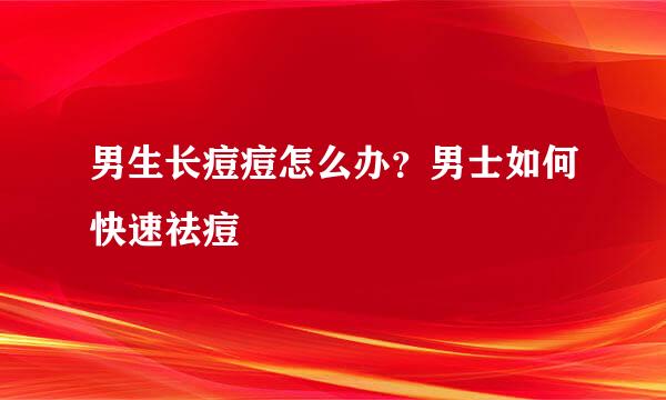 男生长痘痘怎么办？男士如何快速祛痘