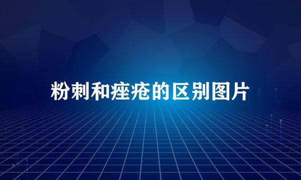 粉刺和痤疮的区别图片