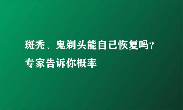 斑秃、鬼剃头能自己恢复吗？专家告诉你概率