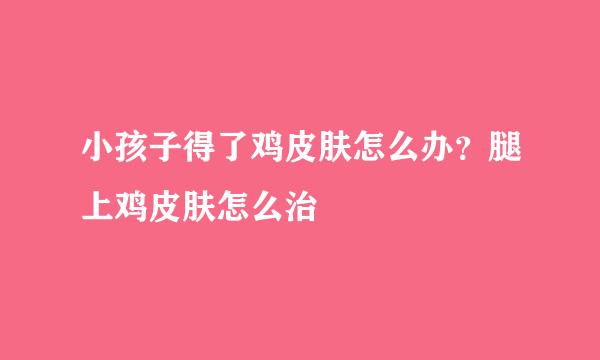 小孩子得了鸡皮肤怎么办？腿上鸡皮肤怎么治