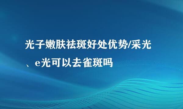 光子嫩肤祛斑好处优势/采光、e光可以去雀斑吗