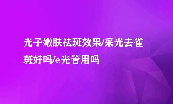 光子嫩肤祛斑效果/采光去雀斑好吗/e光管用吗