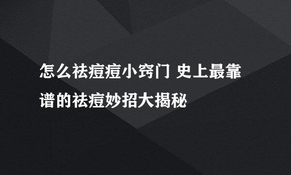 怎么祛痘痘小窍门 史上最靠谱的祛痘妙招大揭秘