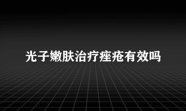 光子嫩肤治疗痤疮有效吗