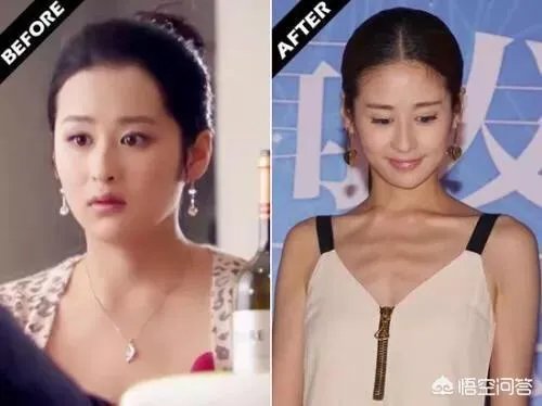颖儿之前因为胖被网友吐槽,为什么如今瘦下来了依旧被说?