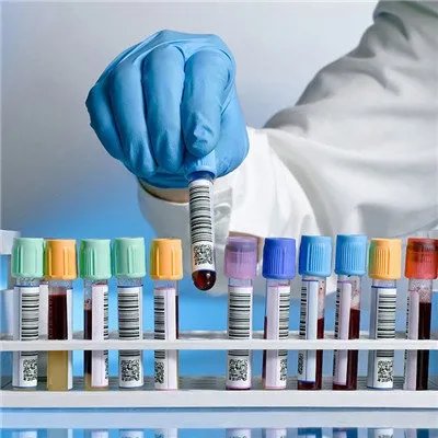 登革热病例症状?
