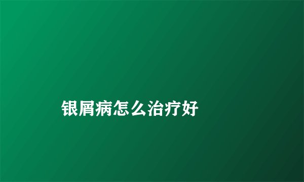 
    银屑病怎么治疗好
  
