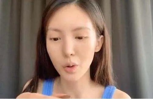 金晨回应嘴歪都说了些什么?