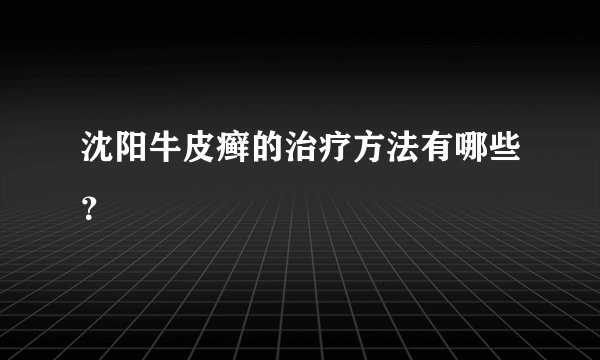 沈阳牛皮癣的治疗方法有哪些？