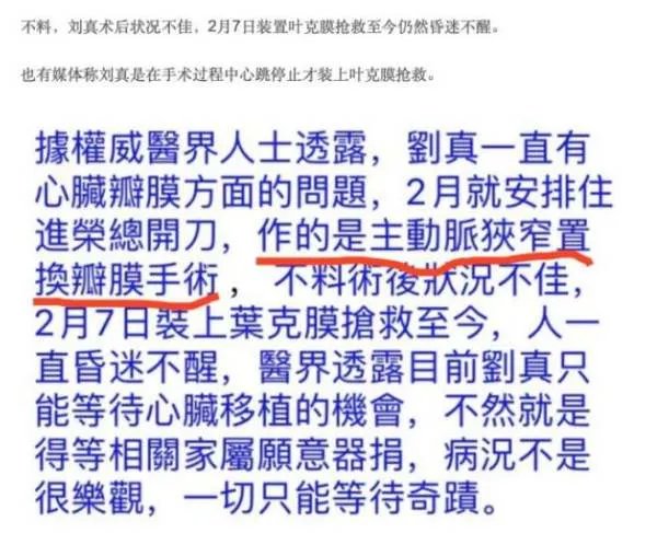 刘真什么原因走的?刘真手术为什么会出现意外
