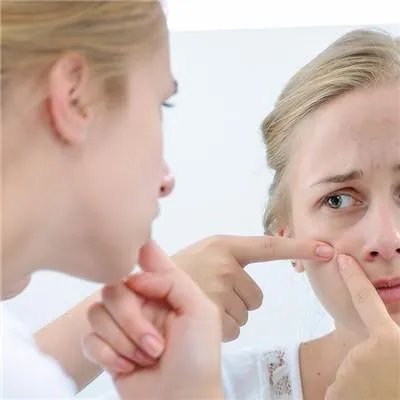 如何消青春痘