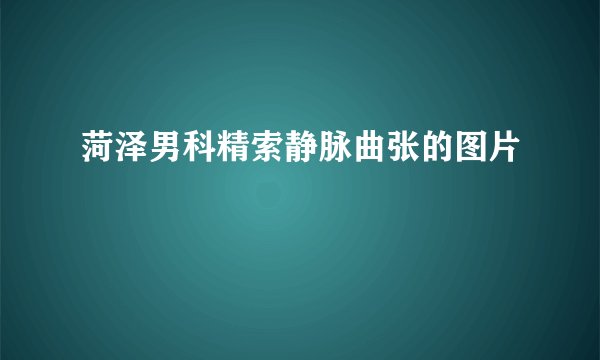 菏泽男科精索静脉曲张的图片