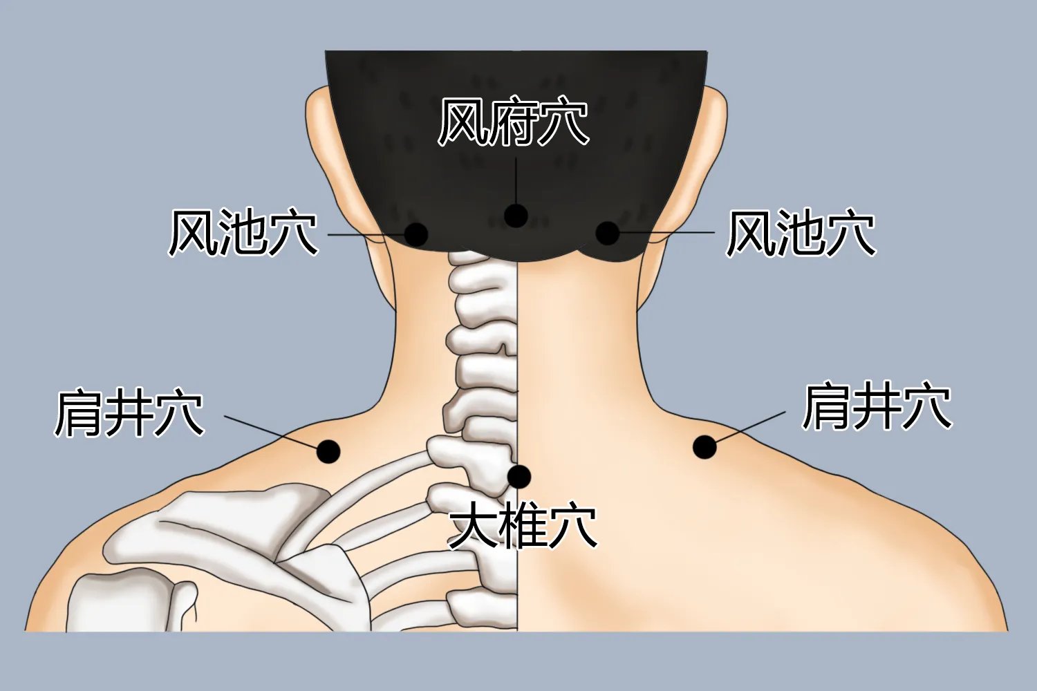 脖子刮痧图片