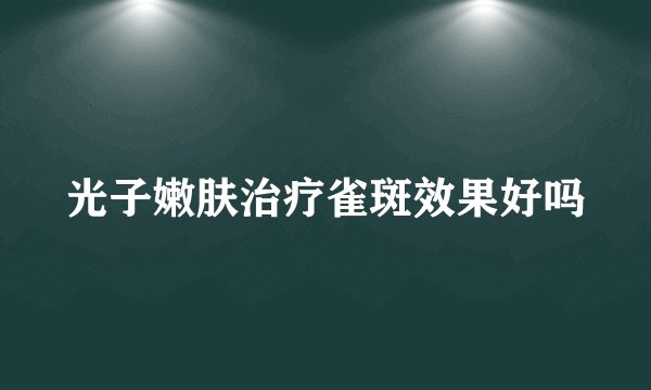 光子嫩肤治疗雀斑效果好吗