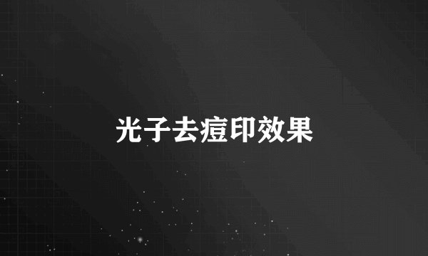 光子去痘印效果