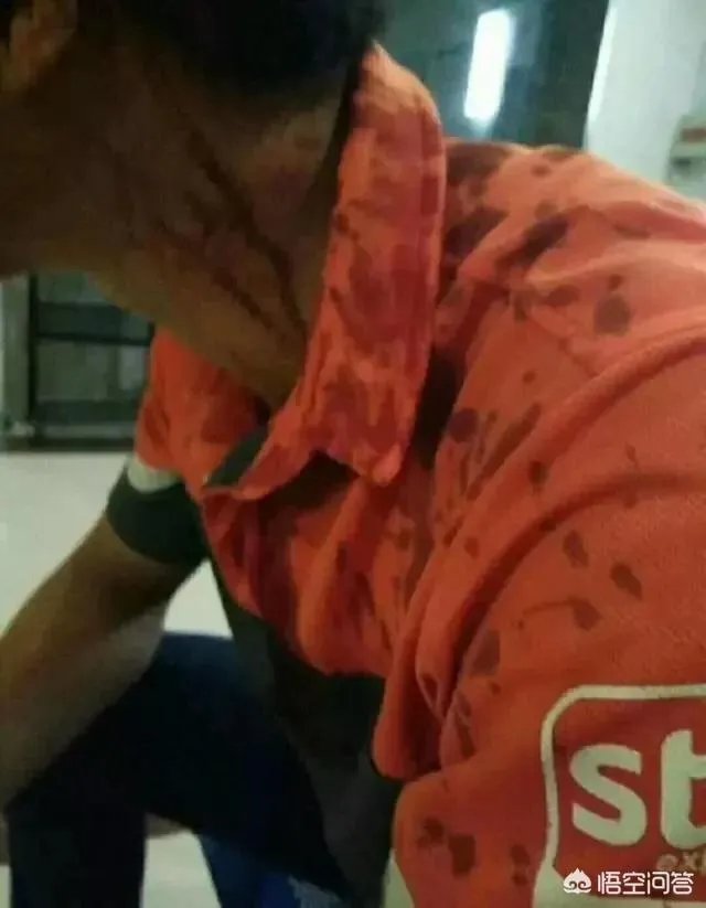 潍坊快递员被打入院,对于此事你怎么看?