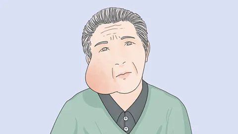 老年人下肢浮肿是怎么回事