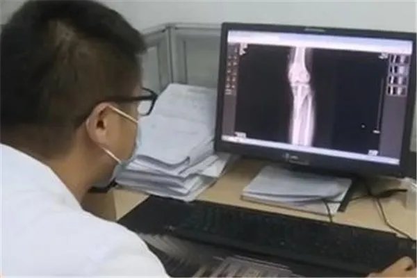 小伙身高不足一米八断骨增高致残疾,为何增高手术会致残?
