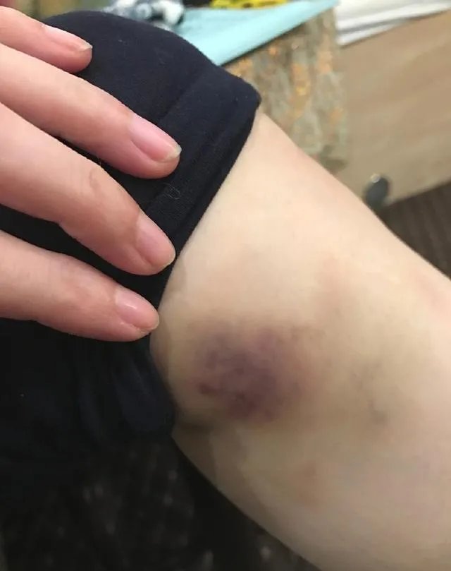 范冰冰穿长袖礼服领奖，背后的原因让人心疼？