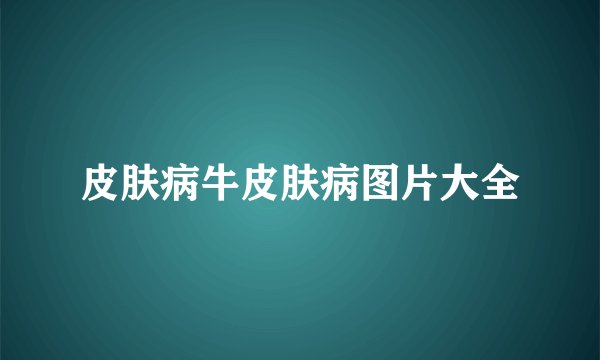 皮肤病牛皮肤病图片大全