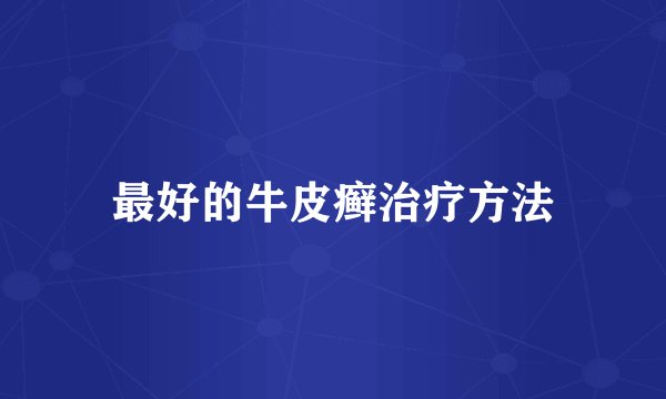 最好的牛皮癣治疗方法