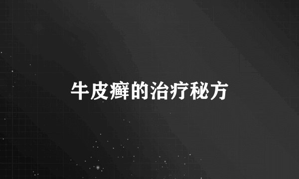 牛皮癣的治疗秘方