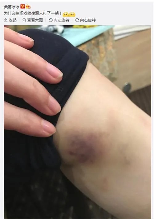范冰冰穿长袖礼服领奖，背后的原因让人心疼？