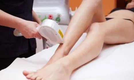 激光全身脱毛要多少钱