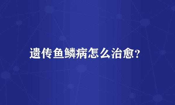 遗传鱼鳞病怎么治愈？