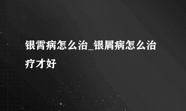 银霄病怎么治_银屑病怎么治疗才好
