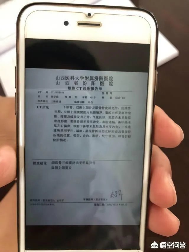 文水女子被无证酒驾司机撞死,丈夫扇肇事者耳光遭全国通缉;多机构伤情鉴定结论不一,丈夫刚解除取保候审。你怎么看?