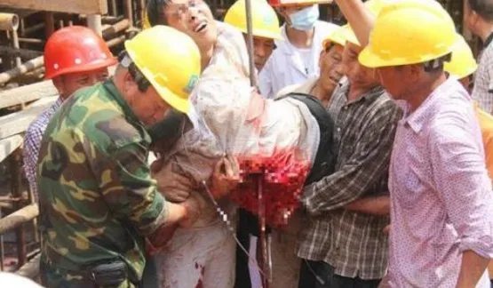 工人被四根钢筋贯穿受伤后情况如何?