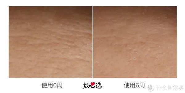 雅诗兰黛精华液好用吗