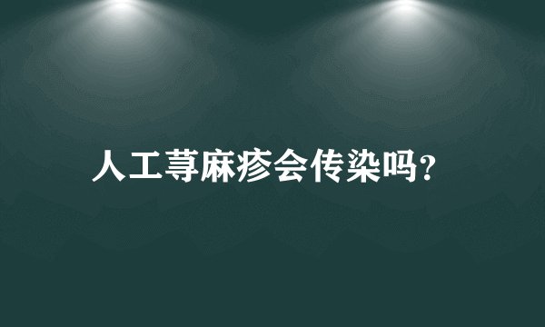 人工荨麻疹会传染吗？