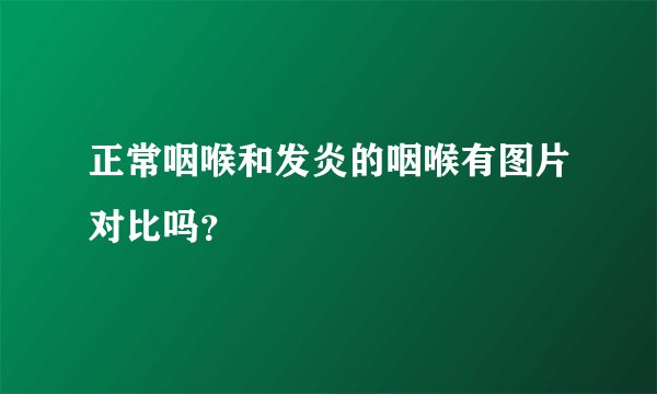 正常咽喉和发炎的咽喉有图片对比吗？
