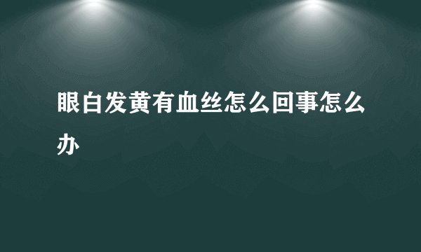 眼白发黄有血丝怎么回事怎么办